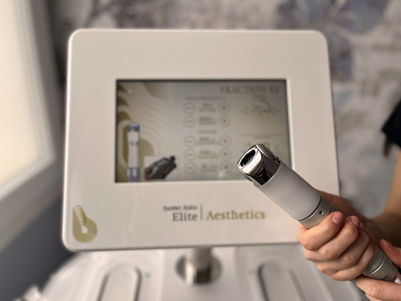 fraction rf tecnologie image 5 sense